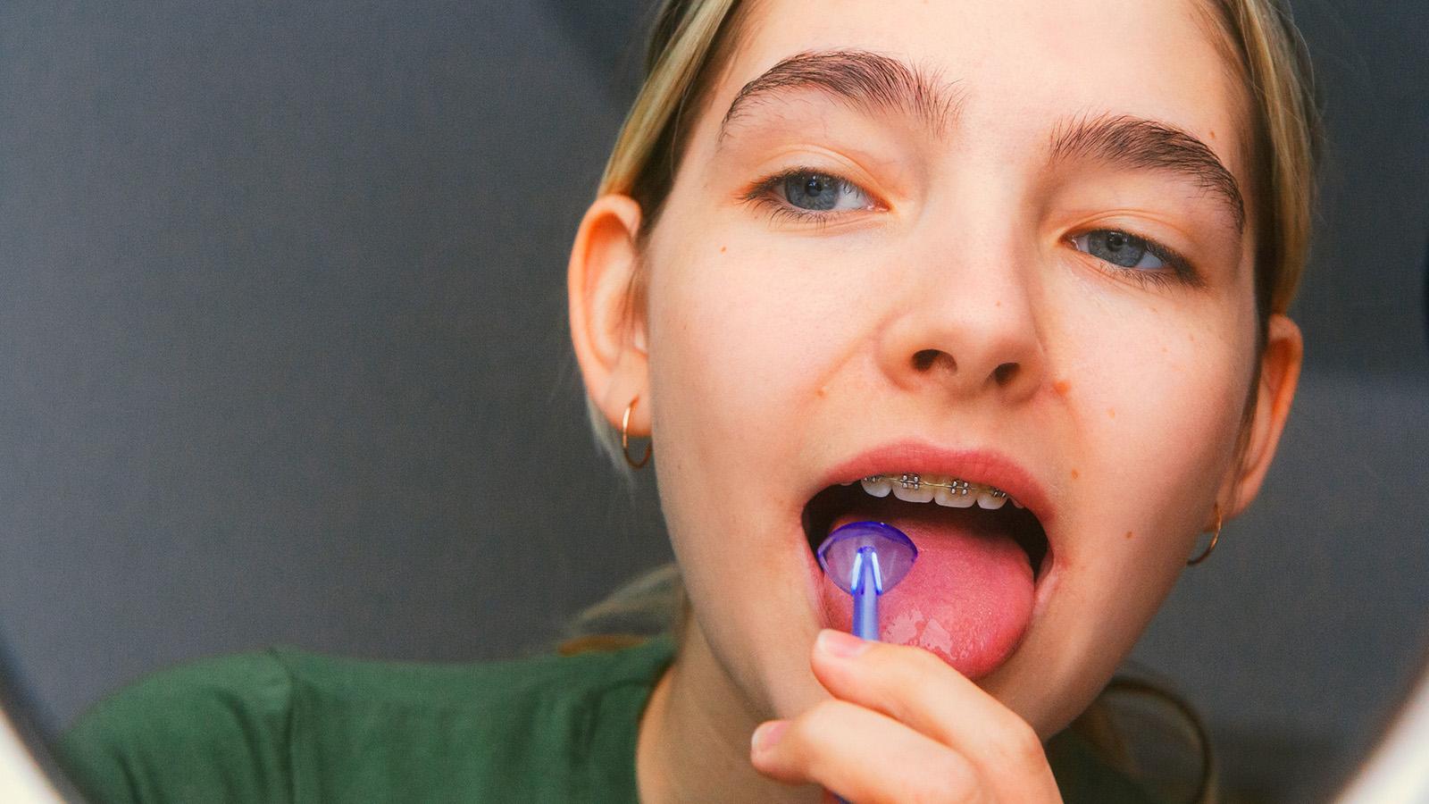 Girl with braces searching for explanations for a weird taste in mouth